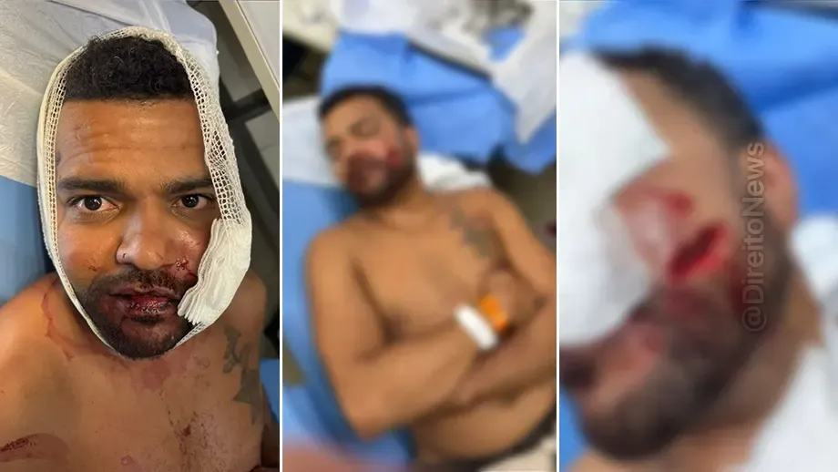 corte profundo achei que ia morrer diz jovem que teve rosto rasgado por advogado