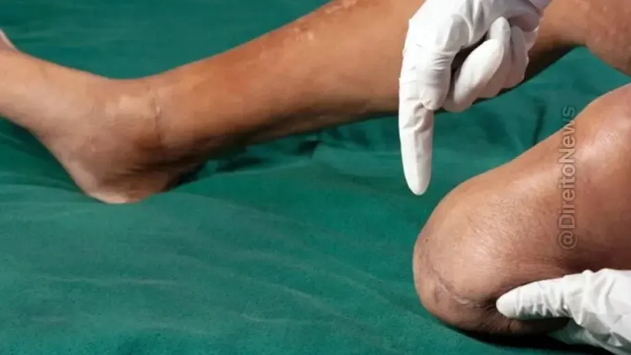 homem recebe indenizacao 74 milhoes invalidez permanente negligencia medica hospitalar