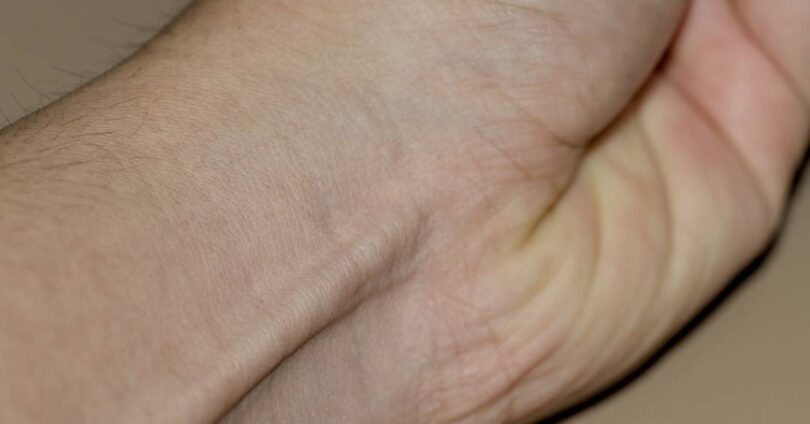 Descubra Como A Evolução Está Fazendo Um Músculo Desaparecer Dos Braços: Você Ainda Tem O Seu? 1 2025 word2