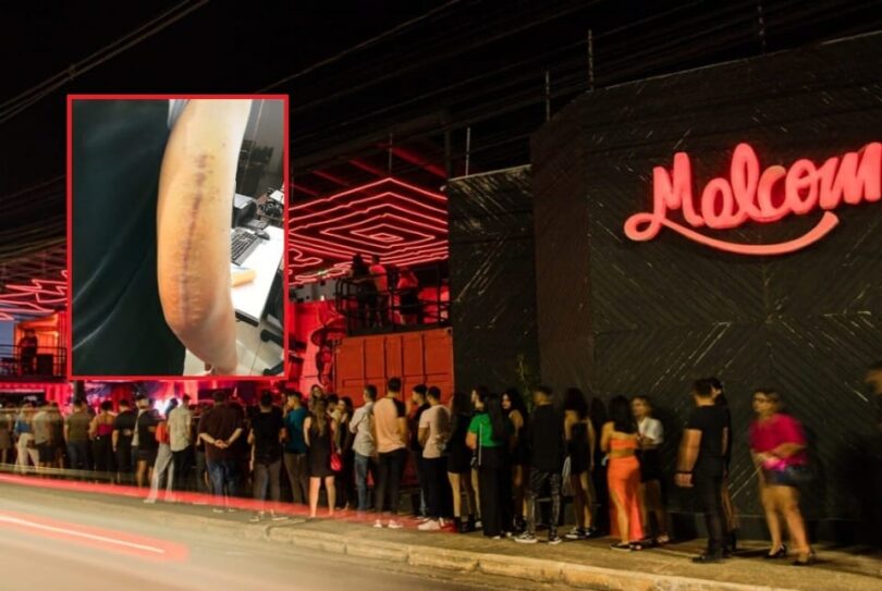 Juiz Determina: Malcom Pub Deve Pagar R$ 40 Mil Por Agressão De Seguranças A Cliente 1 2025 word2