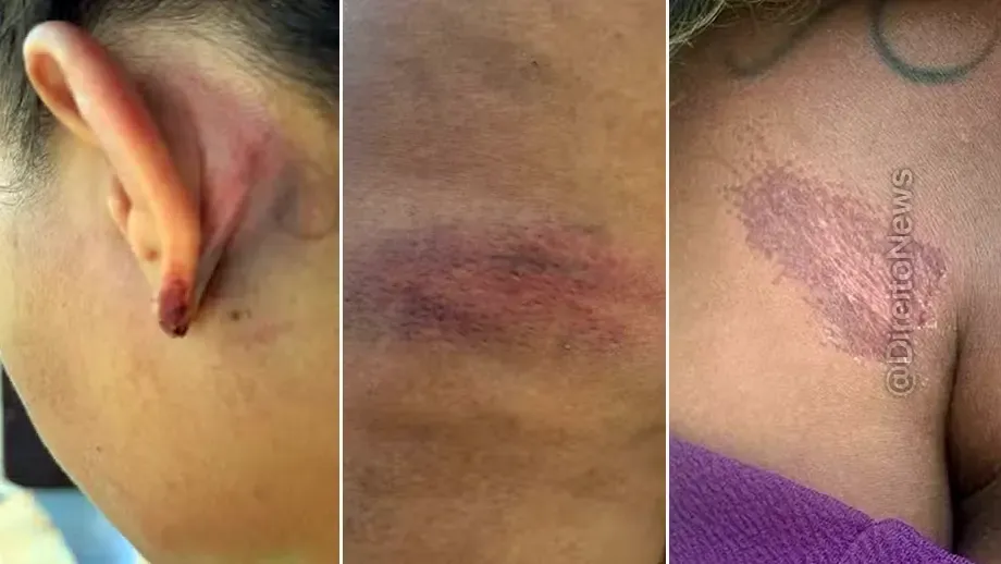 Pm Afasta 10 Policiais Denuncia Agressoes Advogada Interior Rn pm afasta 10 policiais denuncia agressoes advogada interior rn