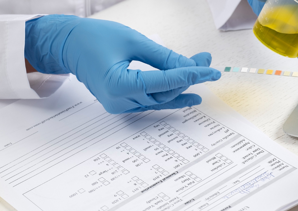 Exame Toxicológico Para Cnh De Carro E Moto Exame toxicológico para CNH de carro e moto