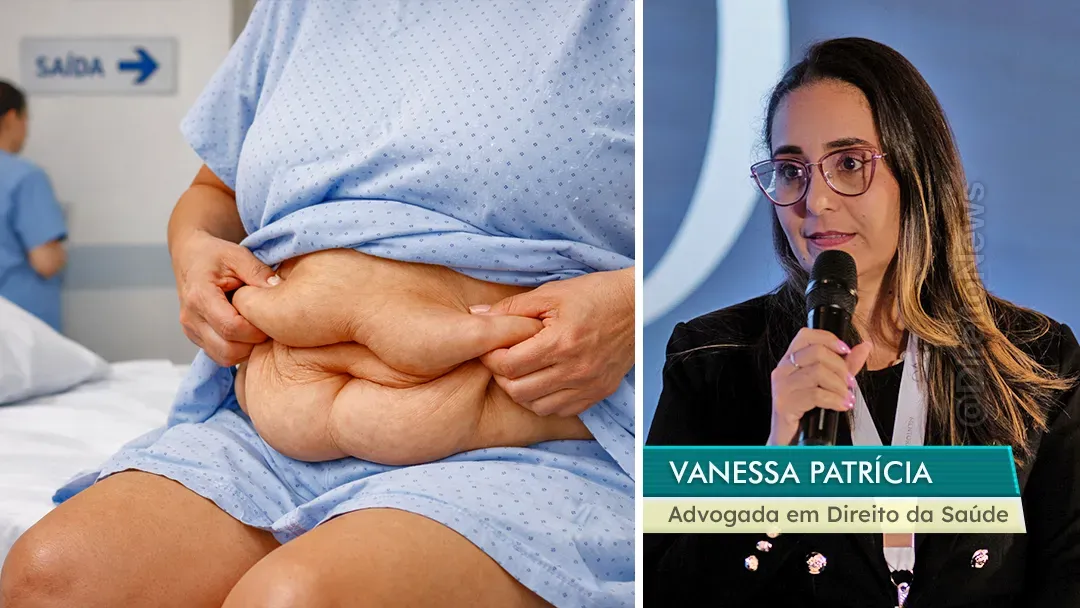 Plano de saúde enfrenta multa de R$ 37,5 mil após descumprir decisão de custeio de cirurgia reparadora pós-bariátrica; defesa destaca fase executiva