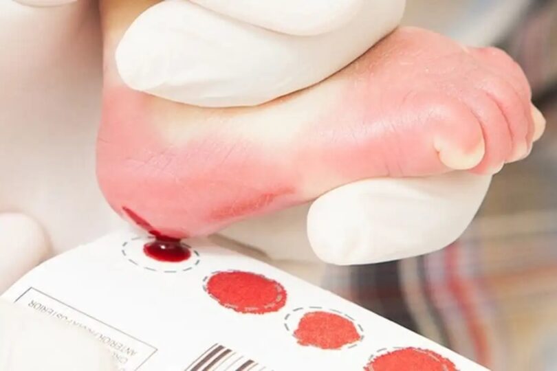 Teste Do Pezinho Ampliado Agora É Gratuito Para Recém-Nascidos Em Mato Grosso Do Sul 1 2026 word2