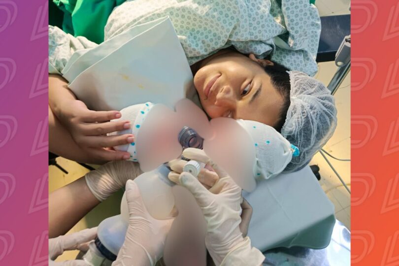 Cirurgia De Separação De Gêmeos Siameses De Mt Marcada Para Os 8 Meses: Saiba Mais! 1 2026 word2