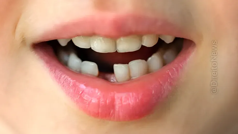 justica nega indenizacao 20 mil paciente dente removido engano mg