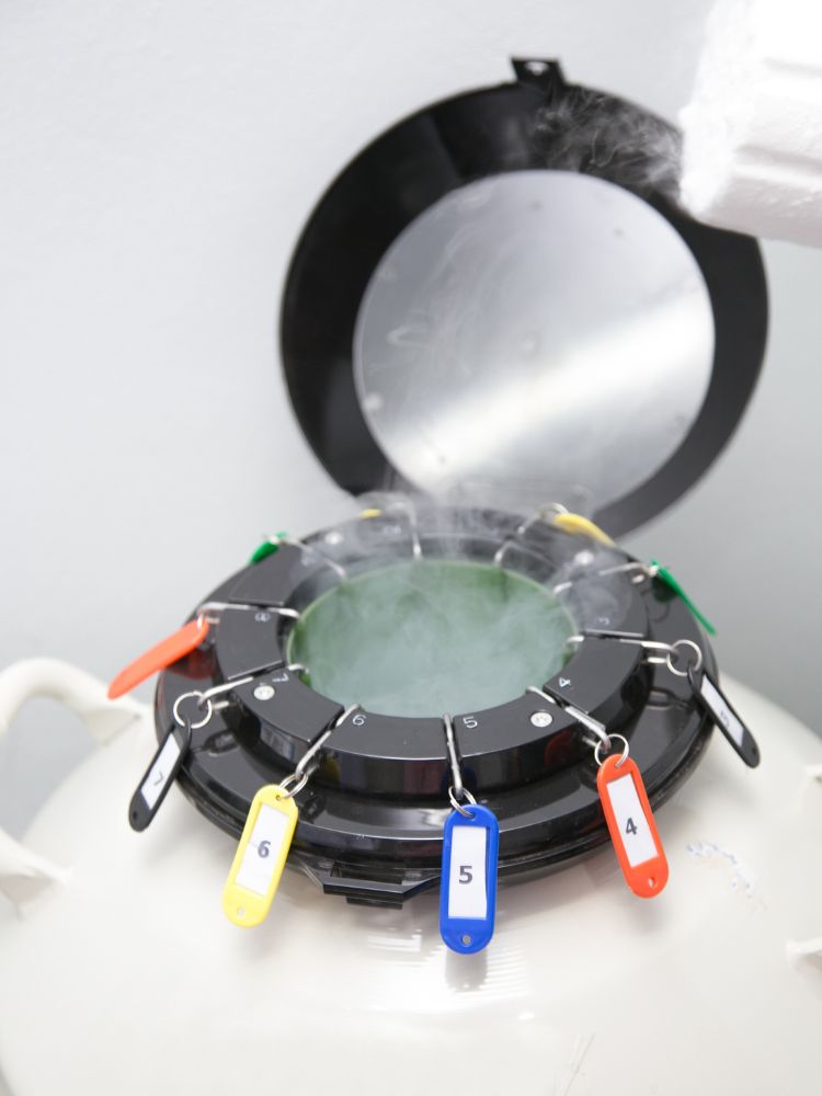 Etapas-Congelamento-Ovulos Máquina de congelar óvulos com etiquetas numeradas e coloridas