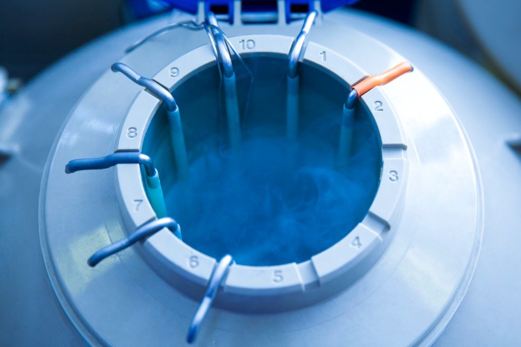 Congelamento-De-Ovulos-3 A imagem mostra um tanque de armazenamento criogênico, usado para conservar óvulos, espermatozoides, embriões ou outros materiais biológicos a baixíssimas temperaturas. O tanque possui uma estrutura cilíndrica de metal com várias aberturas numeradas ao redor da borda. Dentro dele, é possível ver vapor frio, sugerindo a presença de nitrogênio líquido, que é utilizado para manter o conteúdo em estado congelado. As hastes e pinças conectadas a cada abertura indicam que cada compartimento é usado para armazenar amostras separadamente, facilitando o acesso e a organização.