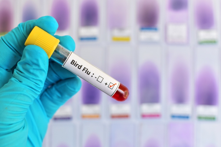 Gripe-Aviaria-1 Pessoa segurando tubo de coleta assinalado para gripe aviária