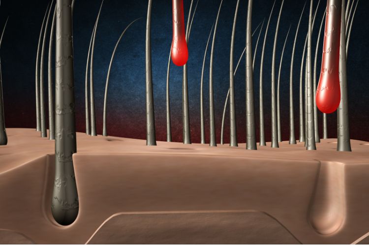 Foliculo-Cabelo-Queda-Dengue Desenho de queda de fios de cabelo na raiz