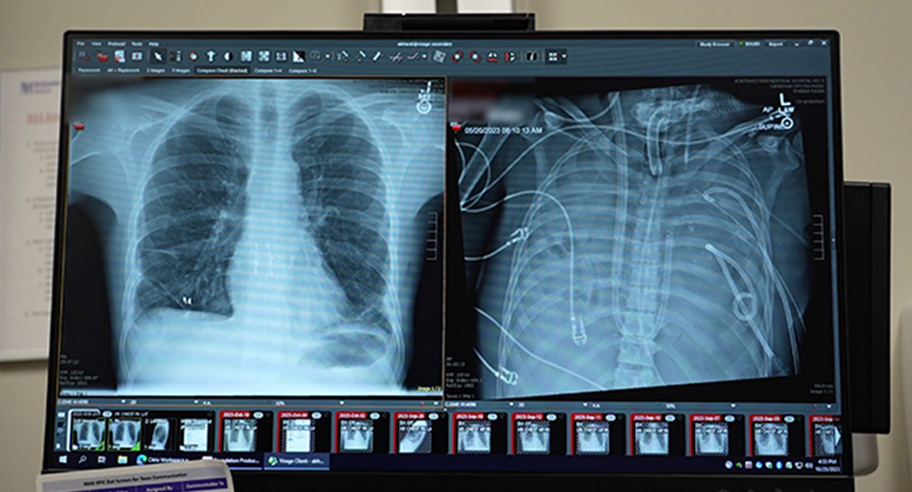 0302-Cirurgiões-Layout_Site1 Fotografia dos pulmões novos (à esquerda) e os pulmões antigos (à direita) dos pacientes.