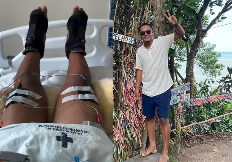 Paciente Testa Polilaminina E Recupera Movimentos Nas Pernas: Confira O Vídeo 1 2026 word2