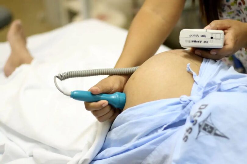 Brasil Ultrapassa 1 Milhão De Cesáreas, Índice Acima Do Recomendado Pela Oms 1 2026 word2