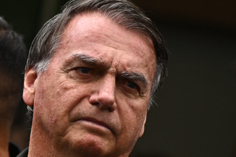 Novo Boletim Médico: Bolsonaro Apresenta Piora Na Função Renal E Segue Na Uti 1 2026 word3