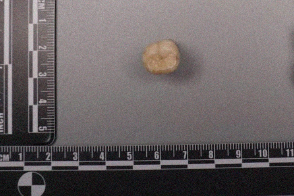 Um dente do Homo erectus, irregular e arredondado, posicionado sobre uma superfície cinza, com réguas de medição em centímetros e polegadas nas bordas inferior e esquerda