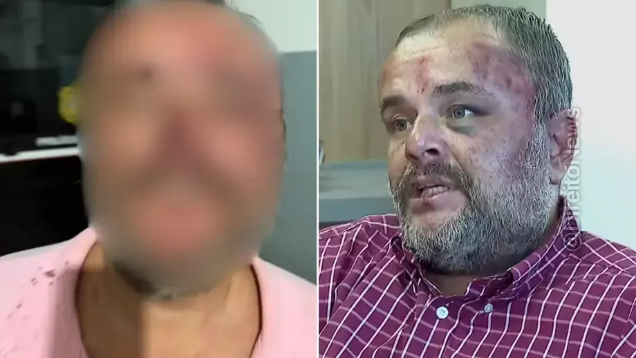 advogado agredido pms diz apresentou carteira digital oab tenente falou ia