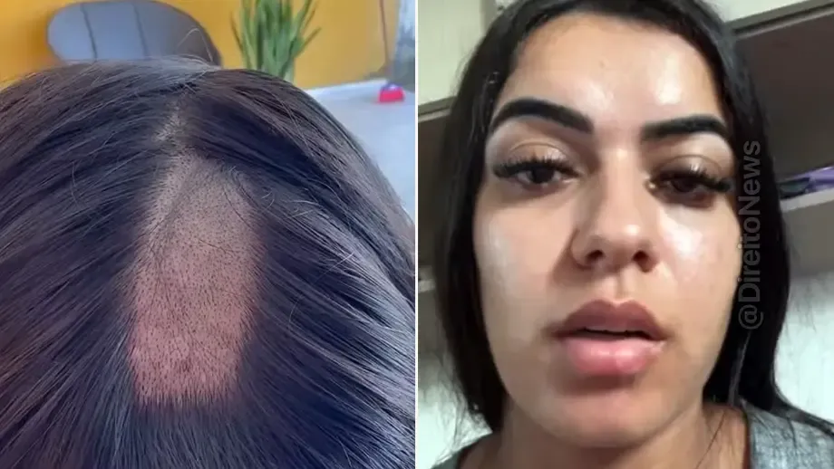 mulher denuncia clinica apos ter cabelo raspado exame toxicologico cnh mulher denuncia clinica apos ter cabelo raspado exame toxicologico cnh