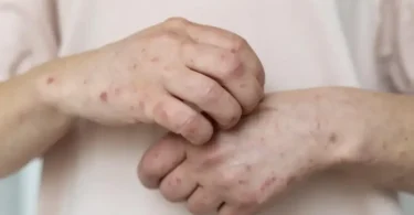 2026